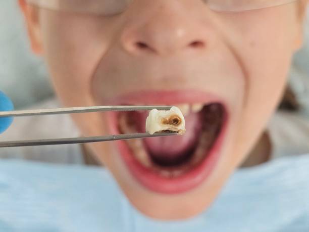 Best Pediatric Emergency Dentist in Hanover, PA
